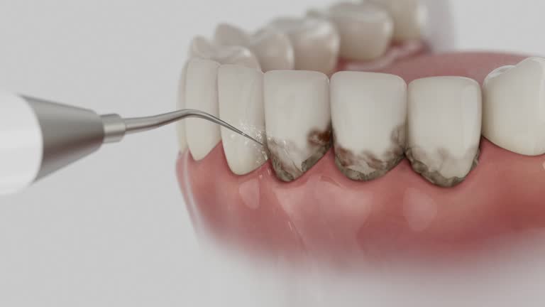 Reliable Emergency Dentist contractor in Clyde, TX by Smile Center Dentistry